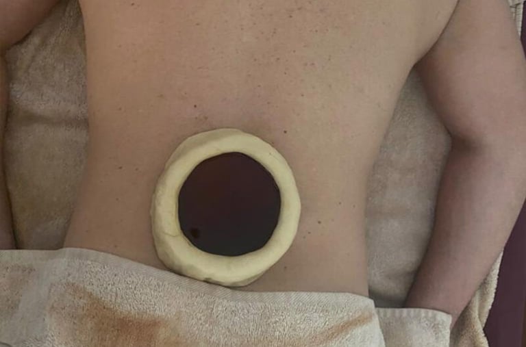 Kati Vasti traditional oil therapy applied to the lower back